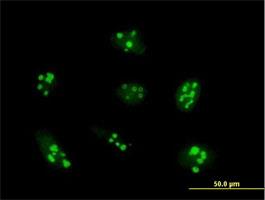 Immunocytochemistry/Immunofluorescence: UTP14A Antibody [H00010813-B01] - Immunofluorescence of purified to UTP14A on formalin-fixed paraffin-embedded HeLa cell. [antibody concentration 10 ug/ml]