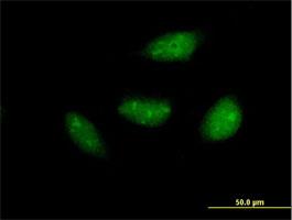 Immunocytochemistry/Immunofluorescence: NOL6 Antibody [H00065083-B01] - Immunofluorescence of purified MaxPab antibody to NOL6 on HeLa cell. [antibody concentration 10 ug/ml]