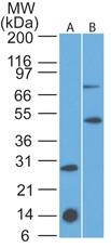 Western Blot: IL7 Receptor alpha Antibody (73N8F2) [Azide Free] [NBP2-25264] - Western blot analysis of A) IL-17R recombinant protein fragment and B) mouse thymus lysate using this antibody at 2 ug/ml.