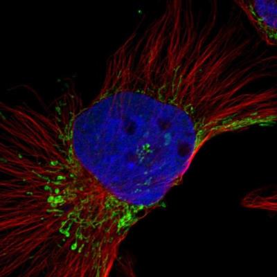 Immunocytochemistry/Immunofluorescence: PHEX Antibody [NBP1-83223] - Staining of human cell line U-251MG shows positivity in mitochondria.