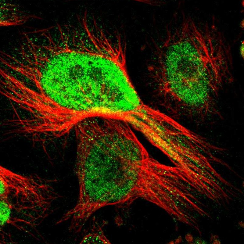 Immunocytochemistry/Immunofluorescence: Hhip Antibody [NBP1-83630] - Staining of human cell line U-251MG shows positivity in nuclei but not nucleoli.
