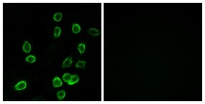 Immunocytochemistry/Immunofluorescence: ATP5G3 Antibody [NBP1-68394] - Analysis of A549 cells, using ATP5G3 Antibody. The picture on the right is treated with the synthesized peptide.