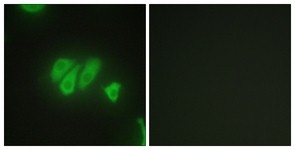 Immunocytochemistry/Immunofluorescence: PDZK3 Antibody [NBP1-67766] - Analysis of HepG2 cells, using PDZK3 Antibody. The picture on the right is treated with the synthesized peptide.