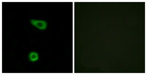 Immunocytochemistry/Immunofluorescence: TNFAIP2 Antibody [NBP1-68002] - Analysis of HuvEc cells, using TNFAIP2 Antibody. The picture on the right is treated with the synthesized peptide.