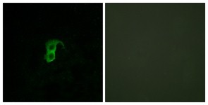 Immunocytochemistry/Immunofluorescence: GPR87 Antibody [NBP1-71089] - Analysis of HuvEc cells, using GPR87 Antibody. The picture on the right is treated with the synthesized peptide.