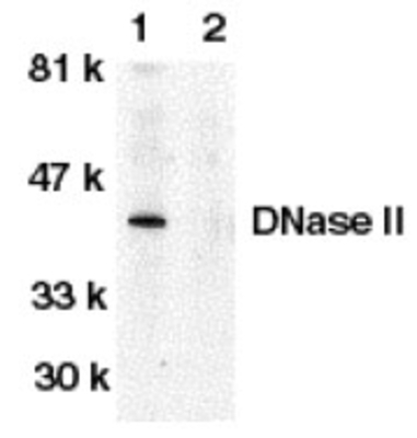 Western Blot: DNase II Antibody [NB100-94212] - Western blot analysis of DNase II in human spleen tissue lysate in the absence (lane 1) or presence (lane 2) of blocking peptide with anti-DNase II (CT) at 1:500 dilution.