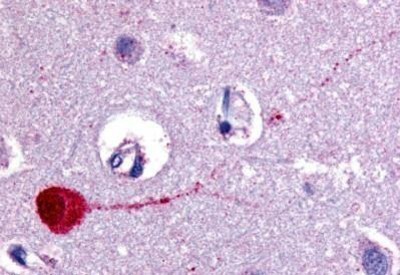Immunohistochemistry-Paraffin: Muscarinic Acetylcholine Receptor M3 Antibody [NB100-58977] - Staining of human brain, cortex. Immunohistochemistry of formalin-fixed, paraffin-embedded tissue after heat-induced antigen retrieval. Antibody concentration 10 ug/ml.