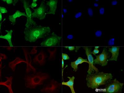 Immunocytochemistry/Immunofluorescence: HDAC7 Antibody [NBP2-03974] - HDAC7 antibody was tested in HeLa cells with DyLight 488 (green). Nuclei and alpha-tubulin were counterstained with DAPI (blue) and Dylight 550 (red).