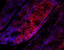 Immunohistochemistry R-Spondin 1 Antibody