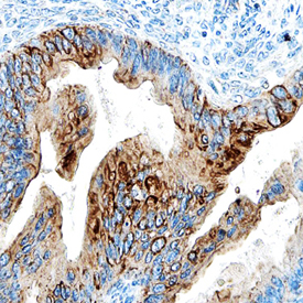 Immunohistochemistry ULBP-4/RAET1E Antibody (709116)