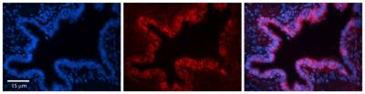 Immunocytochemistry/Immunofluorescence: SQLE Antibody [NBP1-80502] - Formalin Fixed Paraffin; Embedded Tissue: Human Bronchial Epithelial Tissue; Observed Staining: Cytoplasmic; Primary Antibody Concentration: 1:100