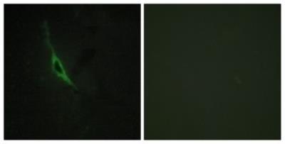 Immunocytochemistry/Immunofluorescence: Granzyme K Antibody [NBP1-66509] - Analysis of NIH-3T3 cells, using. The picture on the right is treated with the synthesized peptide.