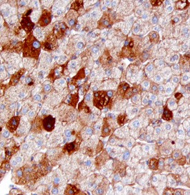 Immunohistochemistry Serum Amyloid A4 Antibody [Unconjugated]