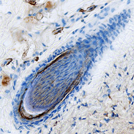 Immunohistochemistry Kallikrein 5 Antibody (880036)
