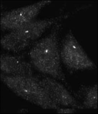 Immunocytochemistry/ Immunofluorescence: UVRAG Antibody [NBP2-30051] - Staining of Autophagy UVRAG antibody (NBP2-30051) on Methanol-fixed HeLa cells. Data courtesy of Dr. Eeva-Liisa Eskelinen, University of Helsinki,Finland.