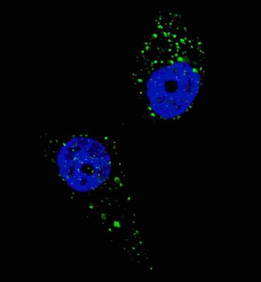 Immunocytochemistry/ Immunofluorescence: UVRAG Antibody [NBP2-30051] - Fluorescent image of U251 cells stained with UVRAG (C-term) antibody. U251 cells were treated with Chloroquine (50 uM,16h), then fixed with 4% PFA (20 min), permeabilized with Triton X-100 (0.2%, 30 min). Cells were then incubated with NBP2-30051 UVRAG (C-term) primary antibody (1:200, 2 h at room temperature). For secondary antibody, Alexa Fluor 488 conjugated donkey anti-rabbit antibody (green) was used (1:1000, 1h). Nuclei were counterstained with Hoechst 33342 (blue) (10 ug/ml, 5 min). UVRAG immunoreactivity is localized to autophagic vacuoles in the cytoplasm of U251 cells.