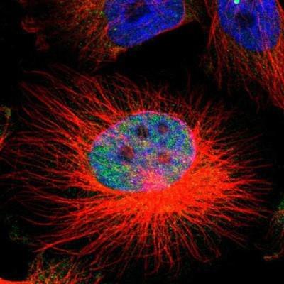 Immunocytochemistry/ Immunofluorescence: CTNNBL1 Antibody [NBP1-88297] -  Staining of human cell line U-251MG shows positivity in nuclei but not nucleoli.