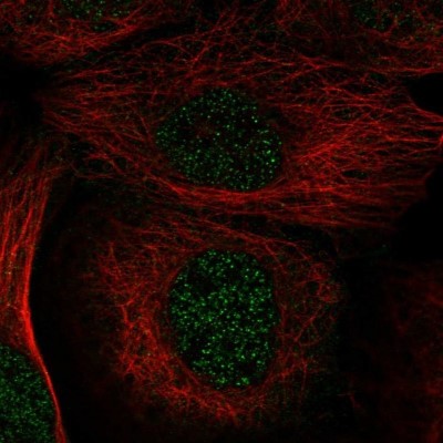 Immunocytochemistry/Immunofluorescence: Xylulokinase/XYLB Antibody [NBP1-87919] - Staining of human cell line A-431 shows positivity in nucleus but not nucleoli.