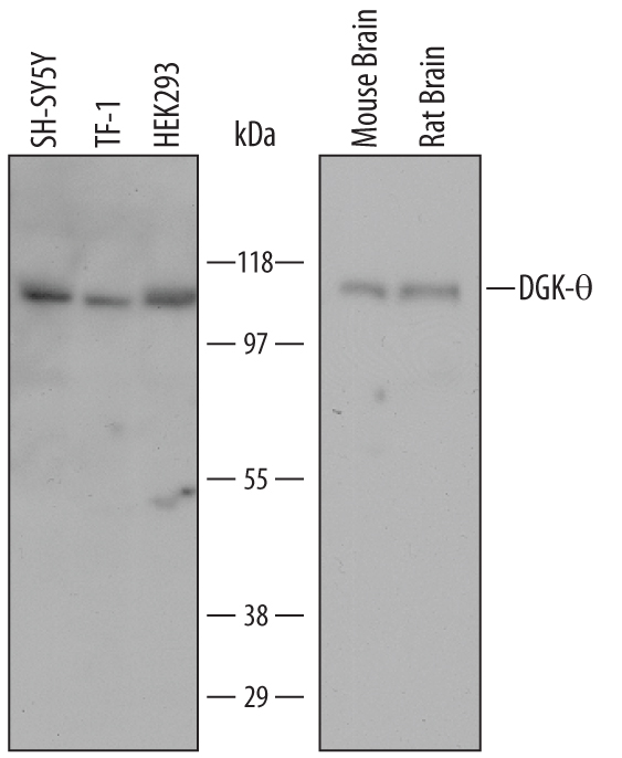 Western Blot DGK-theta Antibody (652308)