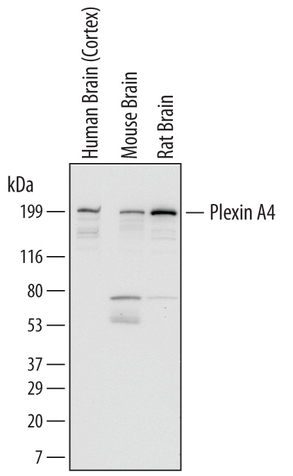 Western Blot Plexin A4 Antibody (707201)