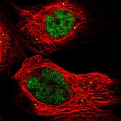 Immunocytochemistry/Immunofluorescence: SKAR Antibody [NBP1-92392] - Staining of human cell line A-431 shows positivity in nucleus but not nucleoli & vesicles.