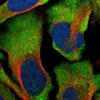 Immunocytochemistry/Immunofluorescence: G3BP2 Antibody [NBP1-82977] - Staining of human cell line U-2 OS shows positivity in cytoplasm.