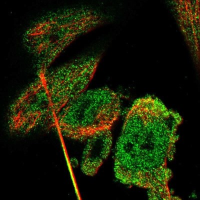 Immunocytochemistry/Immunofluorescence: CBR3 Antibody [NBP1-87065] - Staining of human cell line U-251MG shows positivity in nucleus but not nucleoli & cytoplasm.