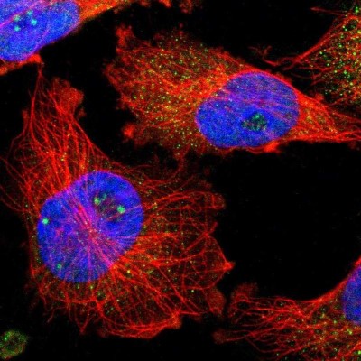 Immunocytochemistry/Immunofluorescence: TIAM2 Antibody [NBP1-80714] - staining of human cell line U-251MG shows positivity in nucleus, nucleoli & cytoplasm.