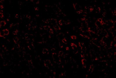 Immunocytochemistry/Immunofluorescence: LDL R Antibody [NBP1-77029] - Immunofluorescence of LDLR in human liver tissue with LDLR antibody at 20 ug/mL.