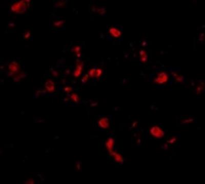 Immunofluorescence: TRAF3IP2 Antibody [NBP1-76723] - Human Lung cells.