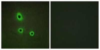 Immunocytochemistry/Immunofluorescence: Ephrin-A5 Antibody [NBP1-67969] - Analysis of A549 cells, using Ephrin- A5 Antibody. The picture on the right is treated with the synthesized peptide.