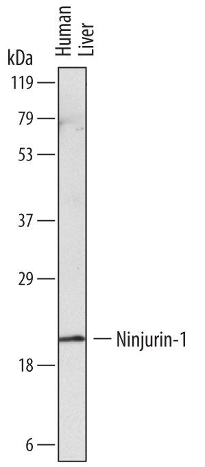 Western Blot Ninjurin-1 Antibody (758943)