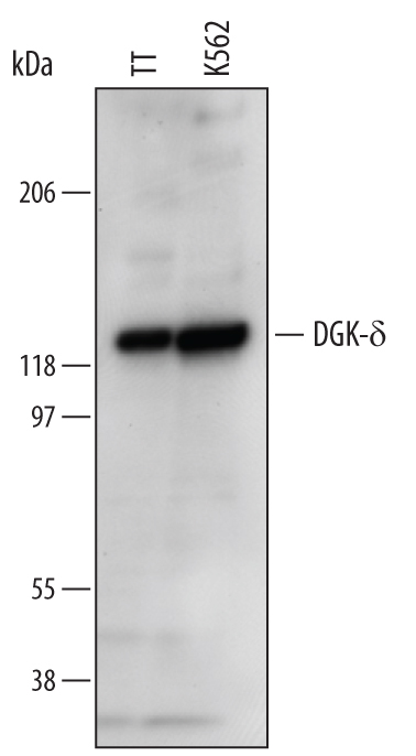 Western Blot DGK-delta Antibody (625423)