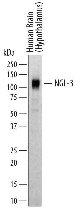 Western Blot NGL-3/LRRC4B/LRCH4B Antibody (702008)
