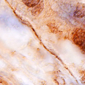 Immunohistochemistry Collagen XIII alpha 1 Antibody (584718)