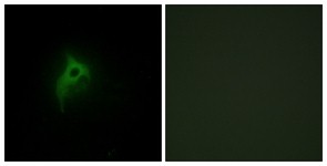 Immunocytochemistry/Immunofluorescence: alpha 2b Adrenergic Receptor Antibody [NBP1-55578] - Analysis of HepG2 cells, using alpha 2b Adrenergic Receptor Antibody. The picture on the right is treated with the synthesized peptide.