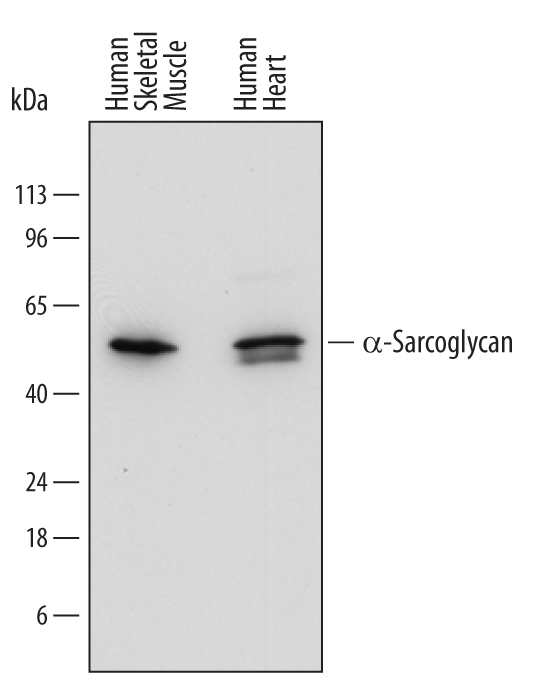 Western Blot alpha-Sarcoglycan Antibody (769109)
