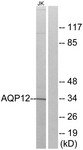 Western Blot: Aquaporin-12A Antibody [NBP1-68387] - Analysis of extracts from Jurkat cells, using Aquaporin-12A Antibody. The lane on the right is treated with the synthesized peptide.