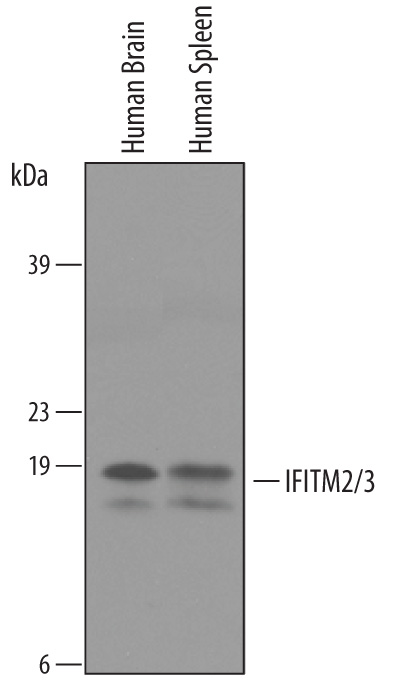 Western Blot IFITM2/IFITM3 Antibody