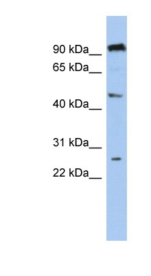 Western Blot: C1orf174 Antibody [NBP1-70453] - 721_B cell lysate, concentration 0.2-1 ug/ml.