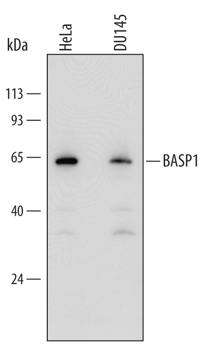 Western Blot BASP1 Antibody