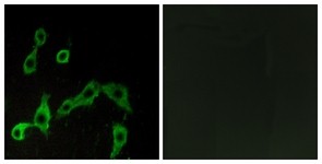 Immunocytochemistry/Immunofluorescence: Alpha 2a Adrenergic Receptor Antibody [NBP1-70919] - Analysis of LOVO cells, using Alpha 2a Adrenergic Receptor Antibody. The picture on the right is treated with the synthesized peptide.
