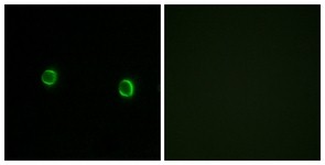 Immunocytochemistry/Immunofluorescence: OR5AS1 Antibody [NBP1-71161] - Analysis of LOVO cells, using OR5AS1 Antibody. The picture on the right is treated with the synthesized peptide.