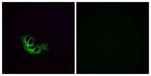 Immunocytochemistry/Immunofluorescence: OR56A1 Antibody [NBP1-71157] - Analysis of HeLa cells, using OR56A1 Antibody. The picture on the right is treated with the synthesized peptide.