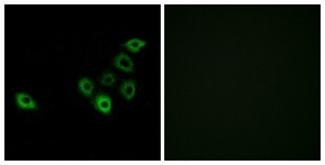 Immunocytochemistry/Immunofluorescence: OR51S1 Antibody [NBP1-71148] - Analysis of A549 cells, using OR51S1 Antibody. The picture on the right is treated with the synthesized peptide.