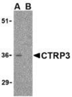 Western Blot: C1qTNF3/CORS26/CTRP3 Antibody [NBP1-76628] - Mouse heart cell lysate with CTRP3 antibody at 1 ug/ml in the (A) absence and (B) presence of blocking peptide.