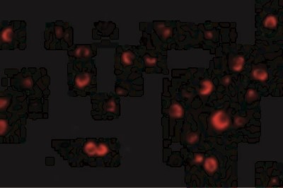 Immunocytochemistry/Immunofluorescence: TSC2 Antibody [NBP1-76619] - Immunofluorescence of TSC2 in L1210 cells with TSC2 antibody at 20 ug/mL.