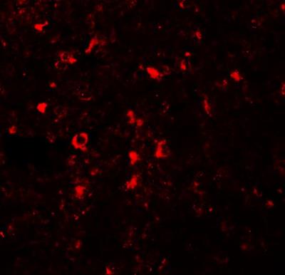 Immunocytochemistry/Immunofluorescence: SLC39A5 Antibody [NBP1-76502] - Immunofluorescence of SLC39A5 in human spleen tissue with SLC39A5 antibody at 20 ug/mL.