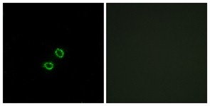 Immunocytochemistry/Immunofluorescence: KIR2DL5B Antibody [NBP1-71611] - Analysis of A549 cells, using KIR2DL5B Antibody. The picture on the right is treated with the synthesized peptide.