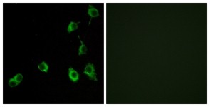 Immunocytochemistry/Immunofluorescence: OR5B12 Antibody [NBP1-71238] - Analysis of COS7 cells, using OR5B12 Antibody. The picture on the right is treated with the synthesized peptide.